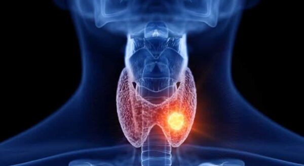 Thyroid health